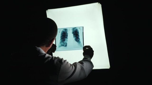 The silhouette of the doctor, studying the Patient's X-ray