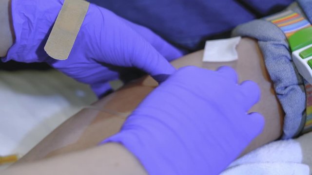 fixation with a patch of needle for intravenous injection to the arm