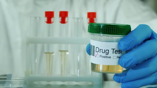 Hand in glove holds a jar with urine analysis where mark a positive test for doping or drug
