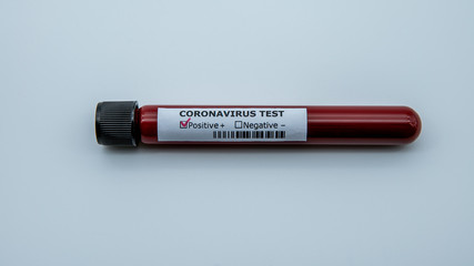 Blood sample tube for corona test, COVID-19. Vaccine research 2019-nCoV.