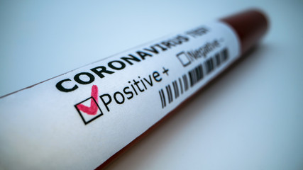 Fototapeta premium Positive COVID-19 test. Laboratory sample of blood testing for infection