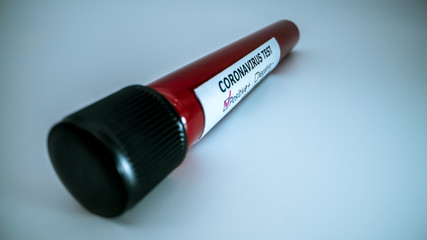 Test tube with infected blood sample for COVID-19, coronavirus from Wuhan