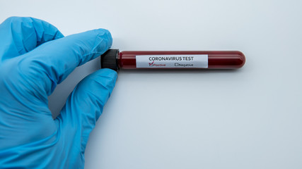 Obraz premium Positive COVID-19 test and laboratory sample blood testing for diagnosis