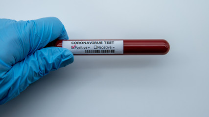 Obraz premium Test tube with infected blood sample for COVID-19, coronavirus from Wuhan