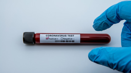 Naklejka premium Positive COVID-19 test and laboratory sample blood testing for diagnosis