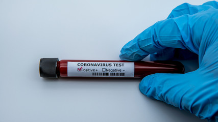 Obraz premium Surgical gloves with a positive coronavirus infected blood sample test.