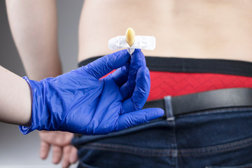 A man at a proctologist's appointment. The doctor holds a rectal suppository before entering the...