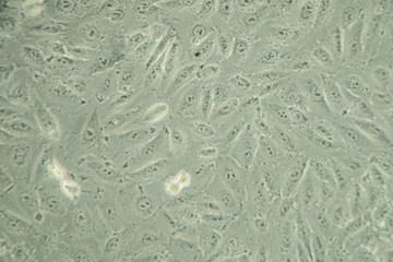 Human cancer cells under microscope background texture