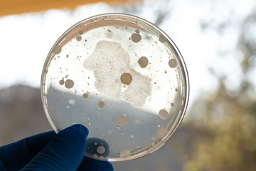 Closeup of gloved hand holding an agar plate with bacterial culture