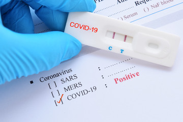 Positive test result by using rapid test device for COVID-19, novel coronavirus 2019 found in Wuhan, China