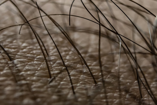 piel humana