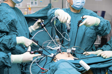 Fototapeta na wymiar Surgeons team hands during laparoscopic abdominal operation in patient surgery in operating room