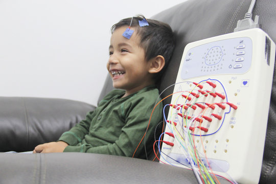 Electroencefalograma estudio del cerebro aplicado a niño