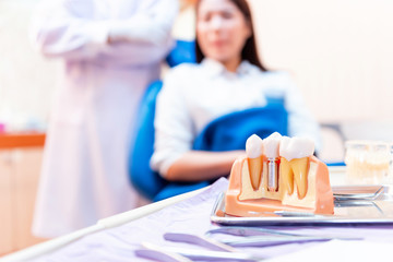 Dentist with tooth implant false teeth. Dentistry and healthcare concept at dental clinic.