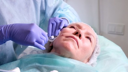 Fototapeta na wymiar Middle aged woman 50 getting a lifting injection of an injection of hyaluronic acid into the face by a doctor cosmetologist. Cosmetic procedure. close-up
