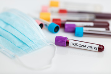 Laboratory sample of the novel Coronavirus