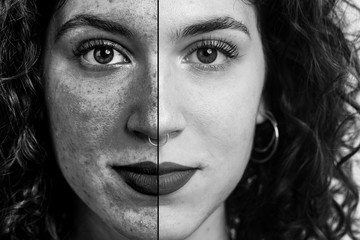 Fototapeta premium Before and after close-up of a skin that needs care after long exposure to uva uvb rays or need revitalisation due to local spots