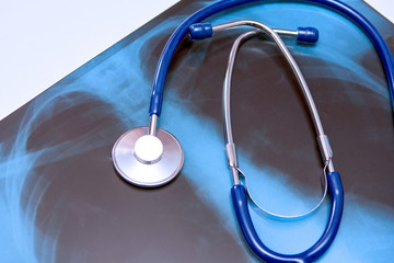 Selective focus of a stethoscope on a chest x-ray film on a hospital table