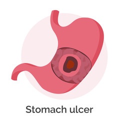 Stomach ulcer isolated icon and inscription. Digestive system with problems. Stomachache caused by infection. Organ suffering from cramps or aches. Indigestion vector in flat style illustration
