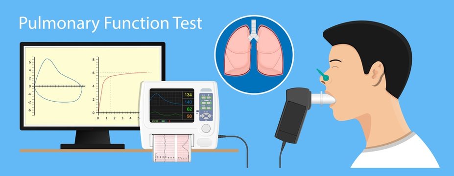 Pulmonary lung medical function test measure diagnostic treat cardiopulmonary total capacity TLC bullous emphysema PFT asbestos fibers