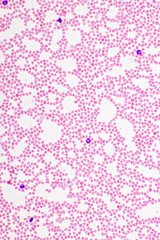 Red blood cells in blood smear, Wright-Giemsa stain, analyze by microscope, 400x
