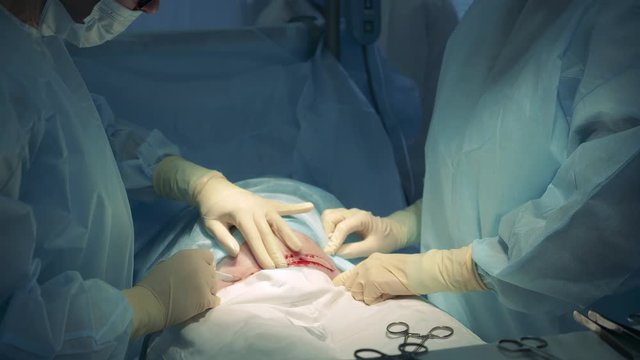 Surgeons are cutting patient's stomach