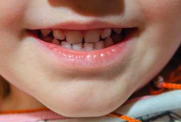 Smile with the teeth of a young child, preschool