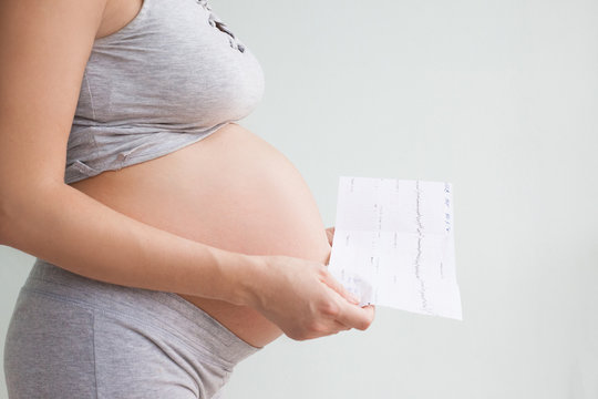 Pregnancy Care. Cardiotocography Fetal Heartbeat Examination. Pregnant Woman Holds In Her Hands The Results Cardiotocography Of The Fetus.  Observation Of The Fetus In The Third Trimester. 