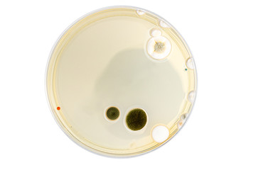 Petri dish with mixed of bacteria colonies
