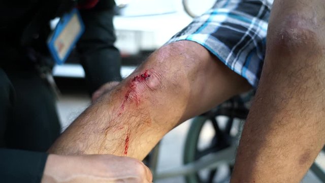 Man on wheel chair heals the wound on his knee at park. Holding the bandage at the hands