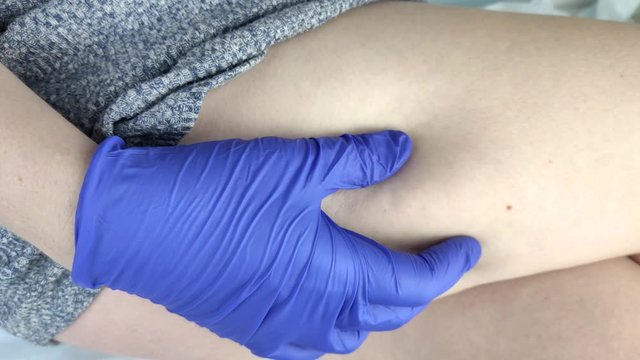 A vascular surgeon examines a leg with varicose veins. Vascular network and blood vessels are shown close-up through a magnifying glass. Preparation for laser treatment and sclerotherapy
