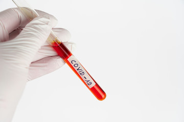 Hand with a laboratory tube with blood sample and the imprint Covid-19