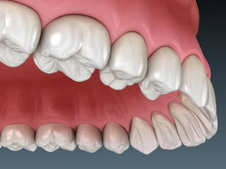 Maxillary human gum and teeth. Medically accurate tooth 3D illustration
