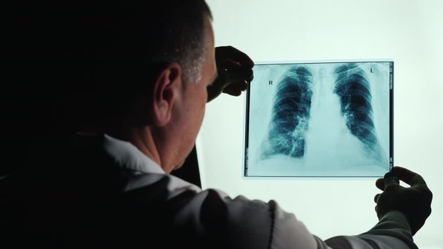 Doctor examines X-ray of lungs