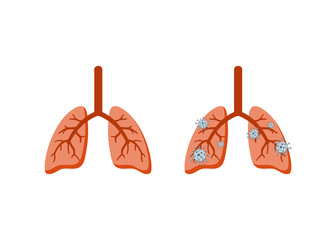 Healthy and diseased lungs Sick lungs infected with cancer virus bacteria coronovirus organ Theme of the medical brochure messages on the danger of lung diseases pneumonia infection cancer Vector