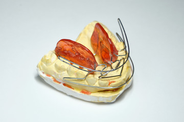Dental prosthesis