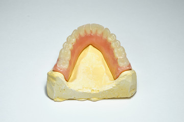 Dental prosthesis