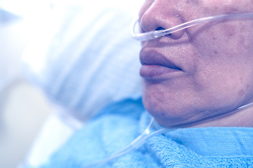 An old asian patient having viral pneumonia were treated with oxygen cannula in the hospital