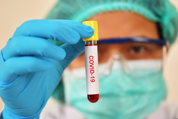 Test tube with blood sample for COVID-19 test, novel coronavirus 2019 found in Wuhan, China