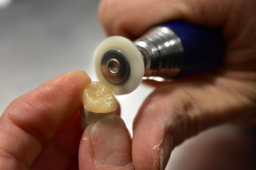 hand with dental drill polishing porcelain crown