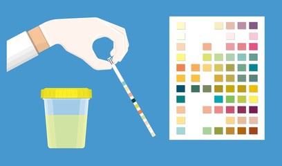 Urine tract exam doctor clinic kidney sick tool pee piss chart color test lab strip pH bottle digital result device medical machine screen science sample measure chronic ketone Diabetes annual © Pepermpron