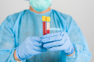 Blood test tubes in medicine hands