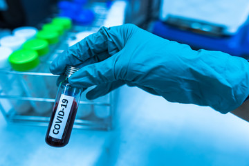 Scientist holding Test tube with blood sample for COVID-19 test,Experiment to detect virus was...