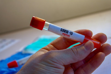 Coronavirus 2019-nCoV Blood Sample. Testing positive to covid-19. Corona Virus in Lab. Scientist hold tube with Blood Test with the Virus Name Coronavirus. Reaching europe, killing in Italy