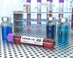 Coronavirus, Covid-19, blood test in hospital laboratory