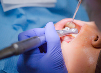 Asian female patient on dentist appointment during dental procedure. Human mouth open close up....
