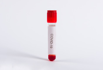 Coronavirus 2019-nCoV Blood Sample in test tubes. Corona virus outbreaking. Epidemic virus Respiratory Syndrome, China. Researching and treatment concept.