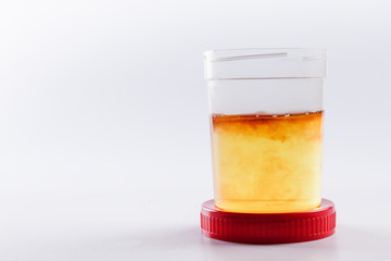 an open jar for medical tests with yellow urine and an admixture of red on a white background stands on the lid of the red color. bad tests. blood and urine analysis