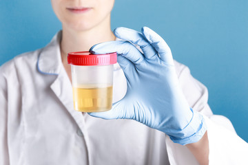 doctor is a white woman in a white medical gown and blue gloves holding a closed jar for medical tests with yellow urine on a blue background