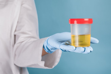 doctor in a white medical gown and blue gloves on a blue background holds in his hand a jar for medical tests with a red lid with yellow urine